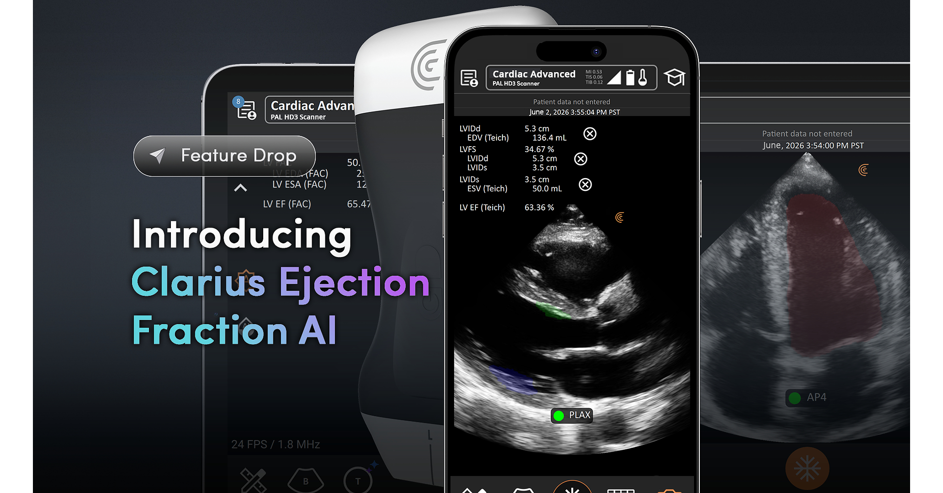 Integrated into the Clarius App, the new AI tool automates LVEF calculation—the key indicator of heart pumping efficiency—to remove subjectivity and accelerate diagnosis using ultrasound at the point of care. VANCOUVER, BC, June 2, 2026 /PRNewswire/ -- Clariu…