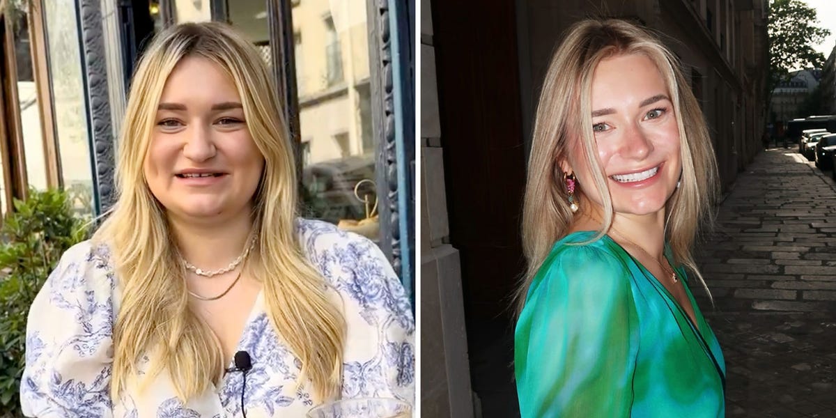 Sasha Sechenova says weight loss, cosmetic procedures, and lifestyle changes helped transform both her appearance and confidence.